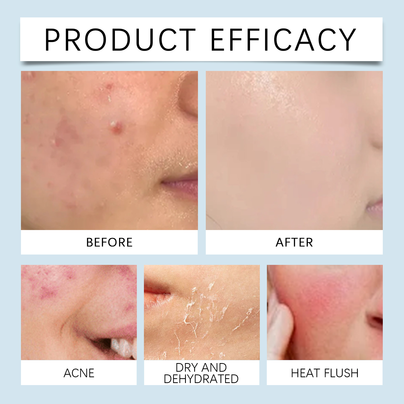 Hydrating roller Serum 0.25mm  - Luxury Skincare Collection avaliação e preço